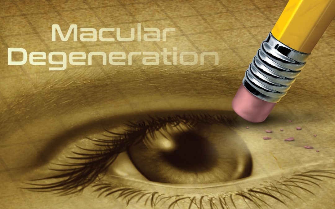 Macular Degeneration